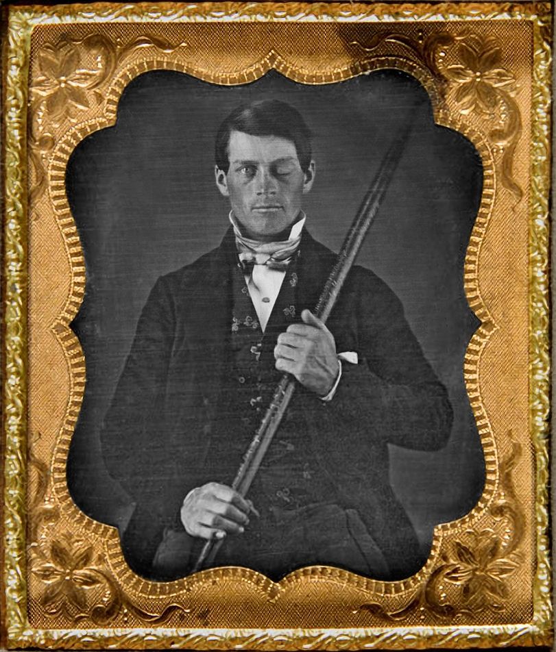 Phineas Gage and the Iron Rod